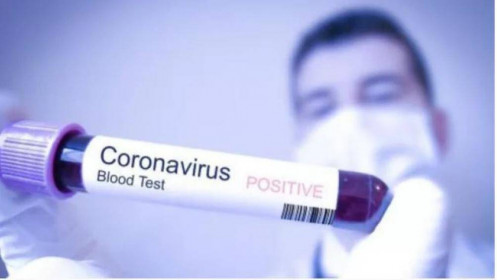 Đại dịch COVID-19: Các nhà khoa học tìm ra điểm yếu của virus