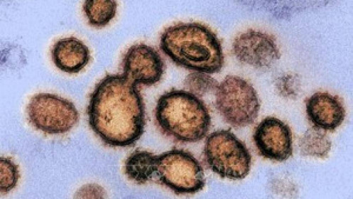 Cuba ghi nhận trường hợp tử vong đầu tiên do nhiễm virus SARS-CoV-2