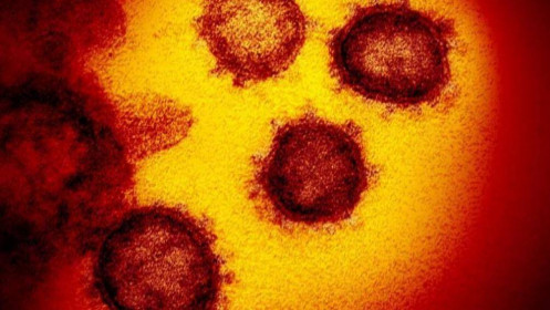 Virus SARS-CoV-2 tồn tại đến 3 ngày trên bề mặt nhựa, inox