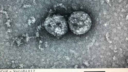 Virus gây dịch Covid-19 tại Việt Nam đã tiến hóa, có sự khác biệt rõ rệt