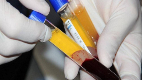 Việt Nam sẽ dùng huyết tương bệnh nhân khỏi bệnh điều trị Covid-19