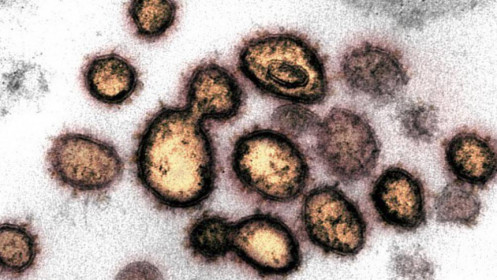Biến chủng SARS-CoV-2 ở Ấn Độ đe dọa nỗ lực điều chế vaccine