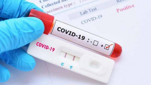 Australia cấp phép sử dụng bộ xét nghiệm Covid-19 tại nhà