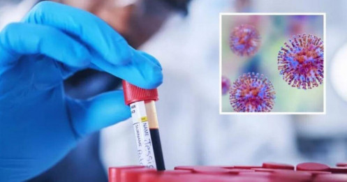 Hơn 300 lọ đựng virus chết người biến mất khỏi phòng thí nghiệm, nhà chức trách vào cuộc điều tra