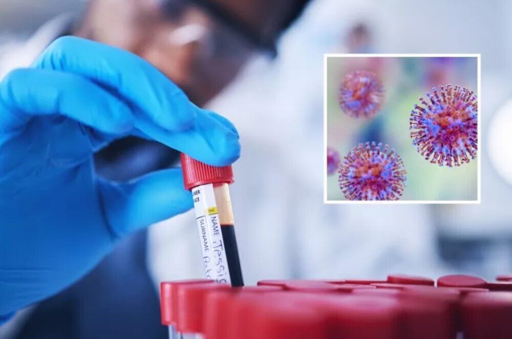 Hơn 300 lọ đựng virus chết người biến mất khỏi phòng thí nghiệm, nhà chức trách vào cuộc điều tra