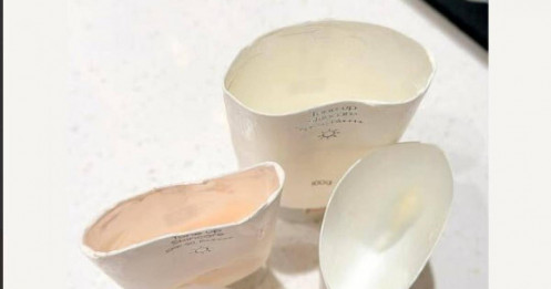 Bất ngờ với số tiền vợ chồng Đoàn Di Băng thu về khi bán 1.652 tuýp kem chống nắng giả