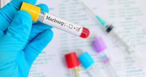 Ethiopia xác nhận sự bùng phát của virus Marbug gây chết người