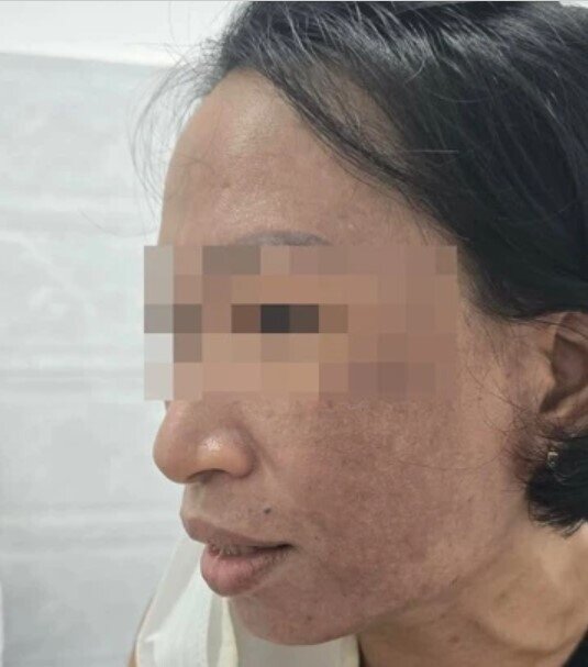 Sức khỏe người tiêu dùng bị đe dọa nghiêm trọng khi dùng mỹ phẩm rởm đột lốt cao cấp của Mailisa