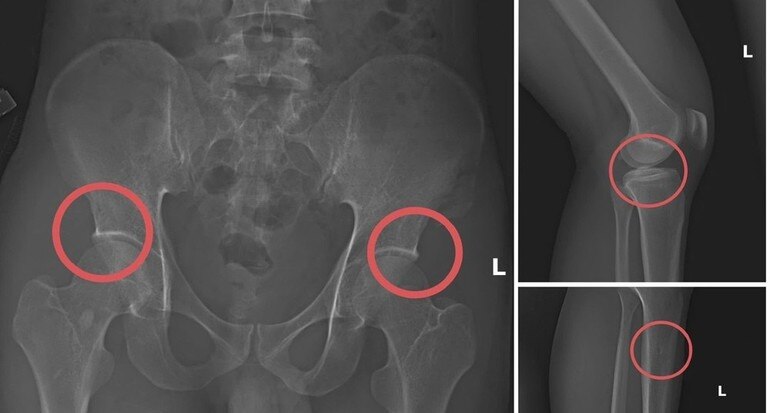 Làn sóng gian lận "càn quét" thị trường bảo hiểm