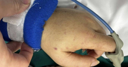 Cảnh báo khẩn từ BV Bạch Mai: Vi khuẩn "tử thần" gây tử vong sau 24h xuất hiện, lây lan cực nhanh qua đường hô hấp