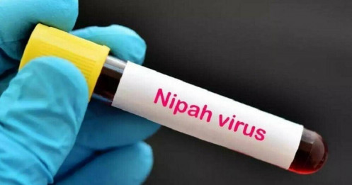 Virus Nipah bùng phát ở Ấn Độ, TP.HCM ra thông báo mới