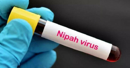 Nipah: Virus 75% tử vong và "cuộc chiến" không vaccine
