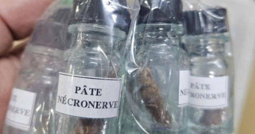 Răng miệng: "Bãi đáp" của chất độc?