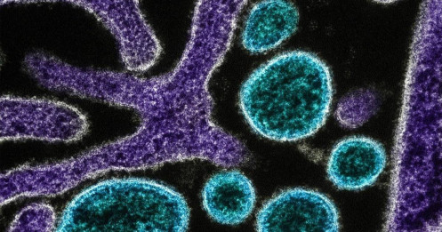 WHO xác nhận ca tử vong do virus Nipah