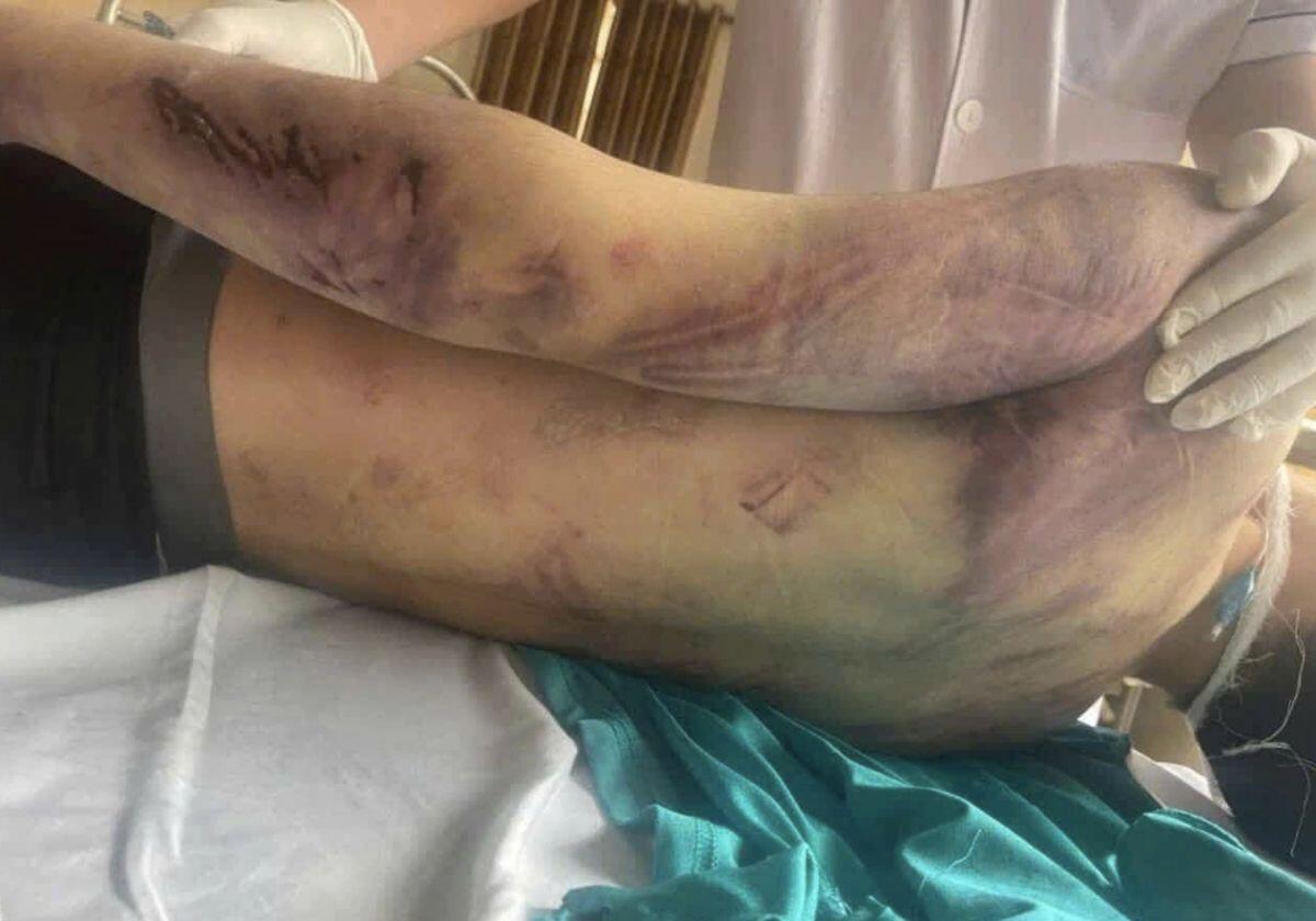 Vụ học viên tử vong sau 2 ngày vào trung tâm: “Giám đốc cam kết sẽ giúp cháu ngoan hơn”
