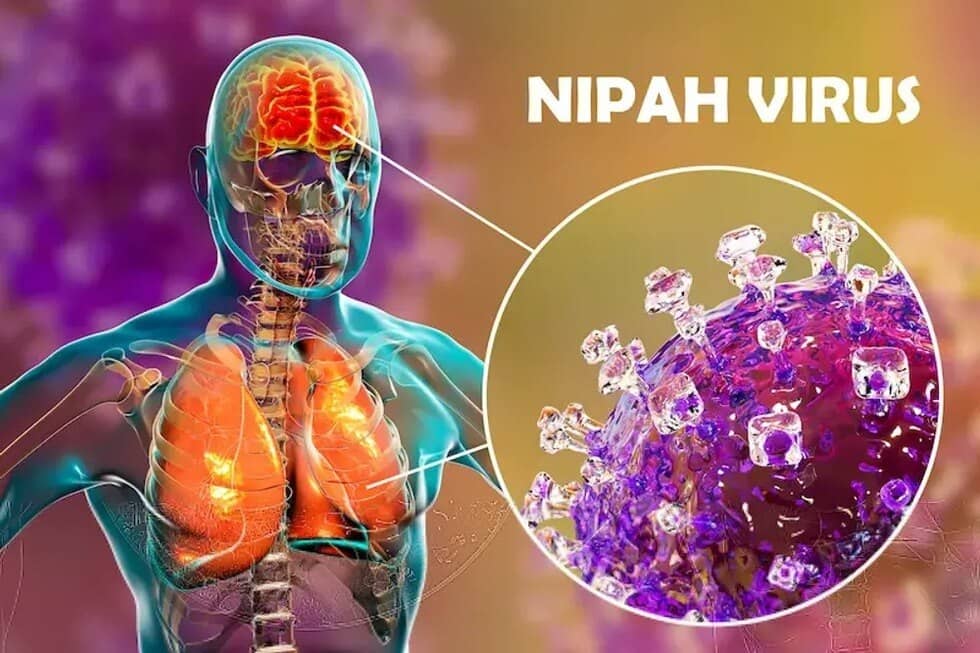 Nipah: Virus 75% tử vong và "cuộc chiến" không vaccine