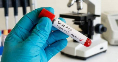 Cảnh báo đỏ với virus Ebola
