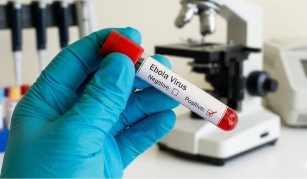 Ebola bùng phát, Bộ Y tế phát cảnh báo