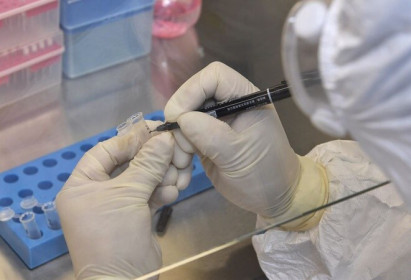 Bộ Y tế đồng ý để Hà Nội xét nghiệm sàng lọc ca nghi nhiễm Covid-19