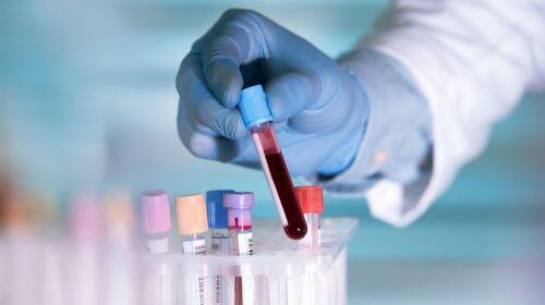 Nghiên cứu người có nhóm máu A dễ bị nhiễm NCoV gây tranh cãi