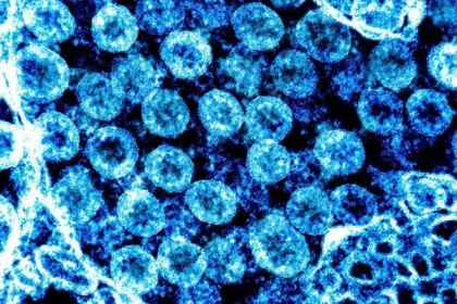Virus SARS-CoV-2 "thay hình đổi dạng" như thế nào để tăng khả năng sống sót ?