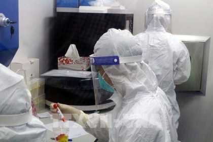 TP Hồ Chí Minh công khai giá xét nghiệm SARS-CoV-2 tại các cơ sở y tế