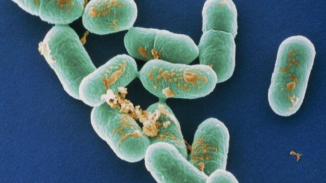 Bùng phát nhiễm nhuẩn listeria chết người ở Mỹ: Liên quan thịt nguội, pho mát