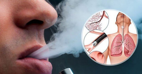 Bộ Công Thương kiến nghị chưa cho lưu hành thuốc lá điện tử