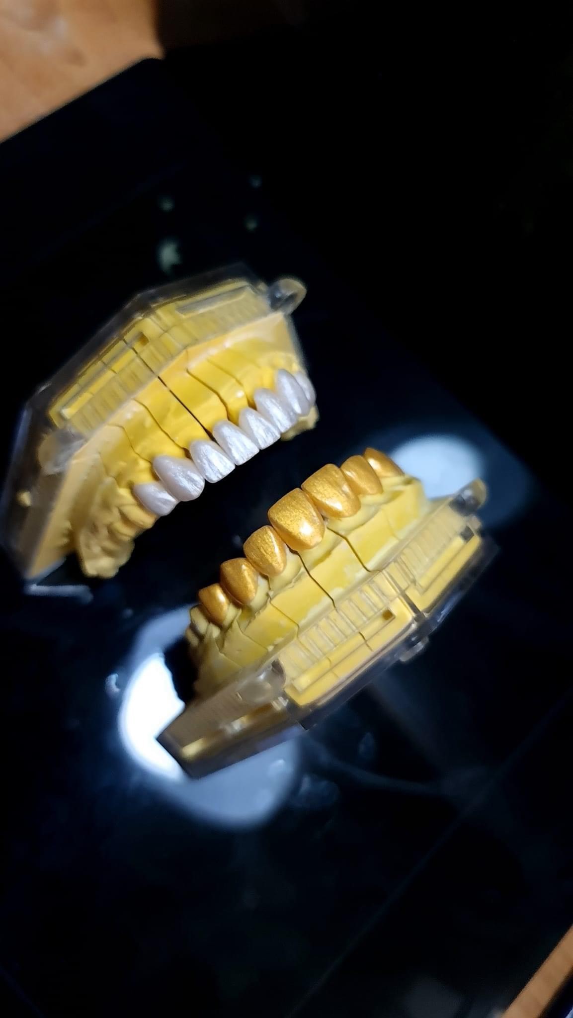 Bio Ceramic - Giải pháp triệt để cho thẩm mỹ nụ cười không biến chứng. Răng sứ Bio-ceramic có tính tối  ...