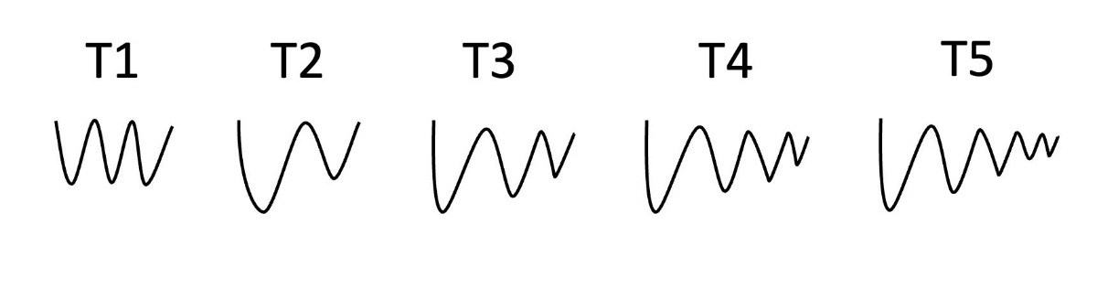 VN-Index liên tục thất bại khi gần mốc 1300, điều gì đang xảy ra với thị trường chứng khoán?